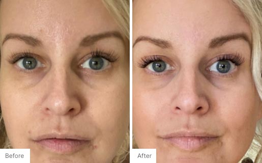 7 - Before and After Real Results photo of a woman's face.